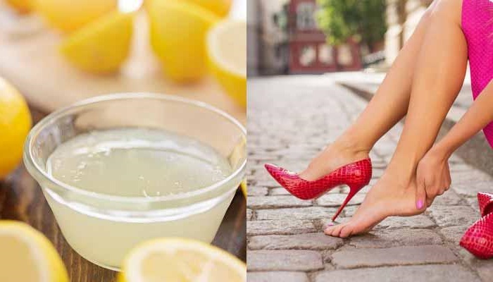 Lime & Sugar For Cracked Heels Treatment