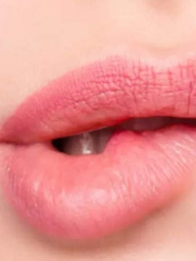 Best Home Remedies For Lightening Black Spots On The Lip